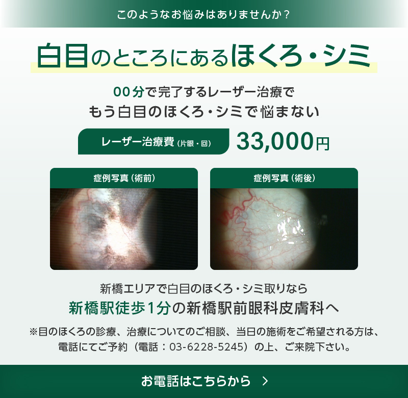 白目のところにあるほくろ・シミ